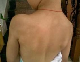 有效预防白癜风 避免环境污染.jpg